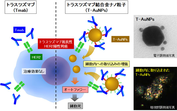 金ナノ粒子を使用したトラスツズマブ抵抗性HER2陽性胃がんに有効な薬剤の開発